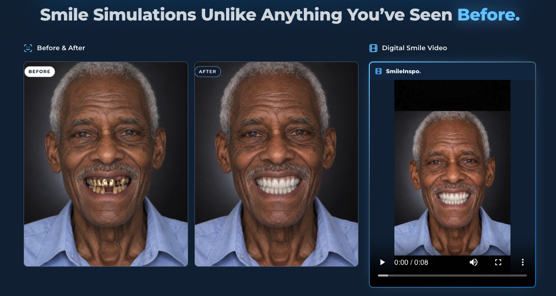 Smile Inspo before-and-after smile simulation alongside a digital smile video preview